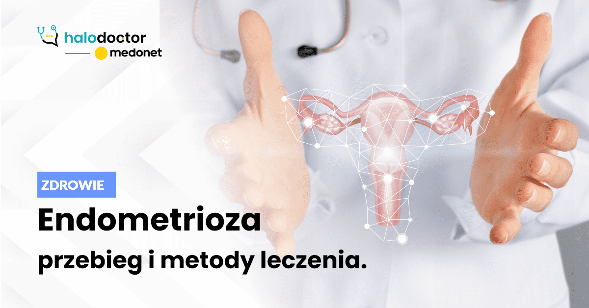Endometrioza – czym jest i jak sobie z nią radzić?