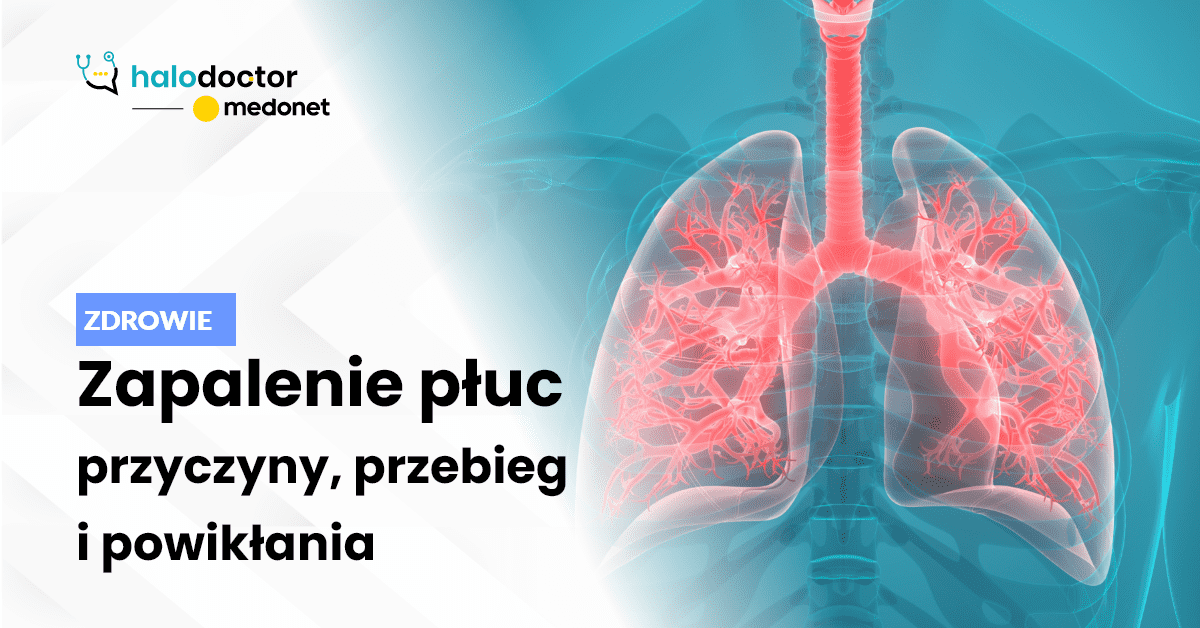 Zapalenie płuc – jakie są następstwa choroby?