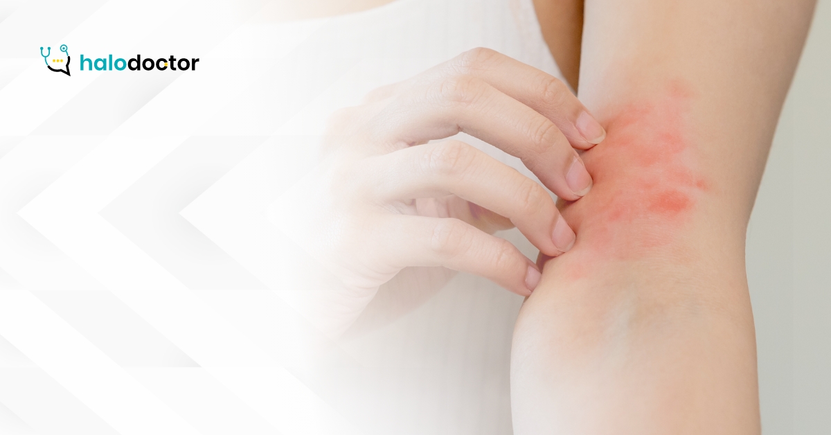 Alergiczne kontaktowe zapalenie skóry. Jak rozpoznać i leczyć?