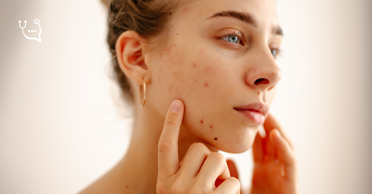 Recepta na Izotek. Terapia trądziku skupionego i przewlekłego