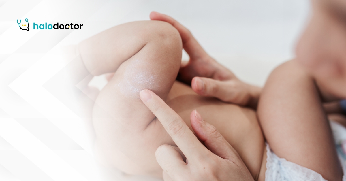 Potówki. Jak pielęgnować skórę niemowląt? Ważne wskazówki