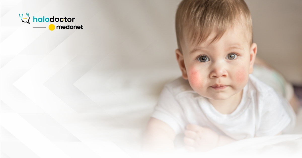 Alergia pokarmowa u niemowląt. Co radzi alergolog?