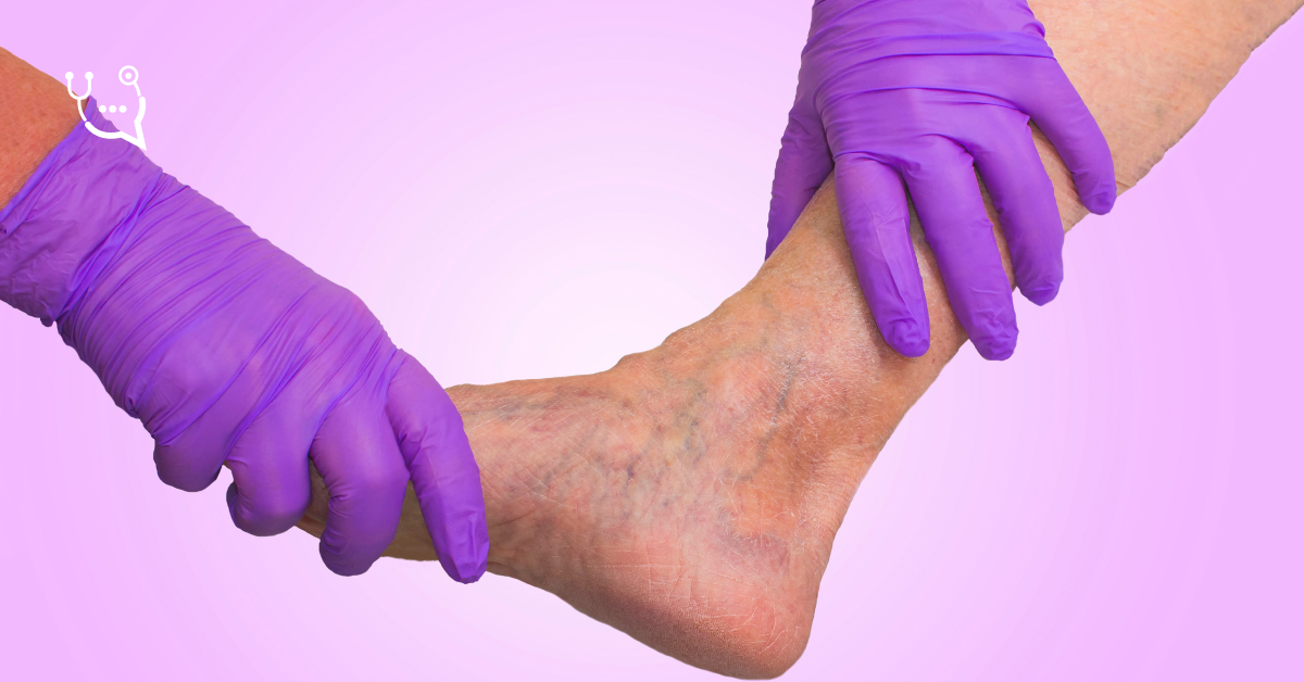 Recepta na Poltixa: redukcja ryzyka nawrotu zakrzepicy i zatorowości