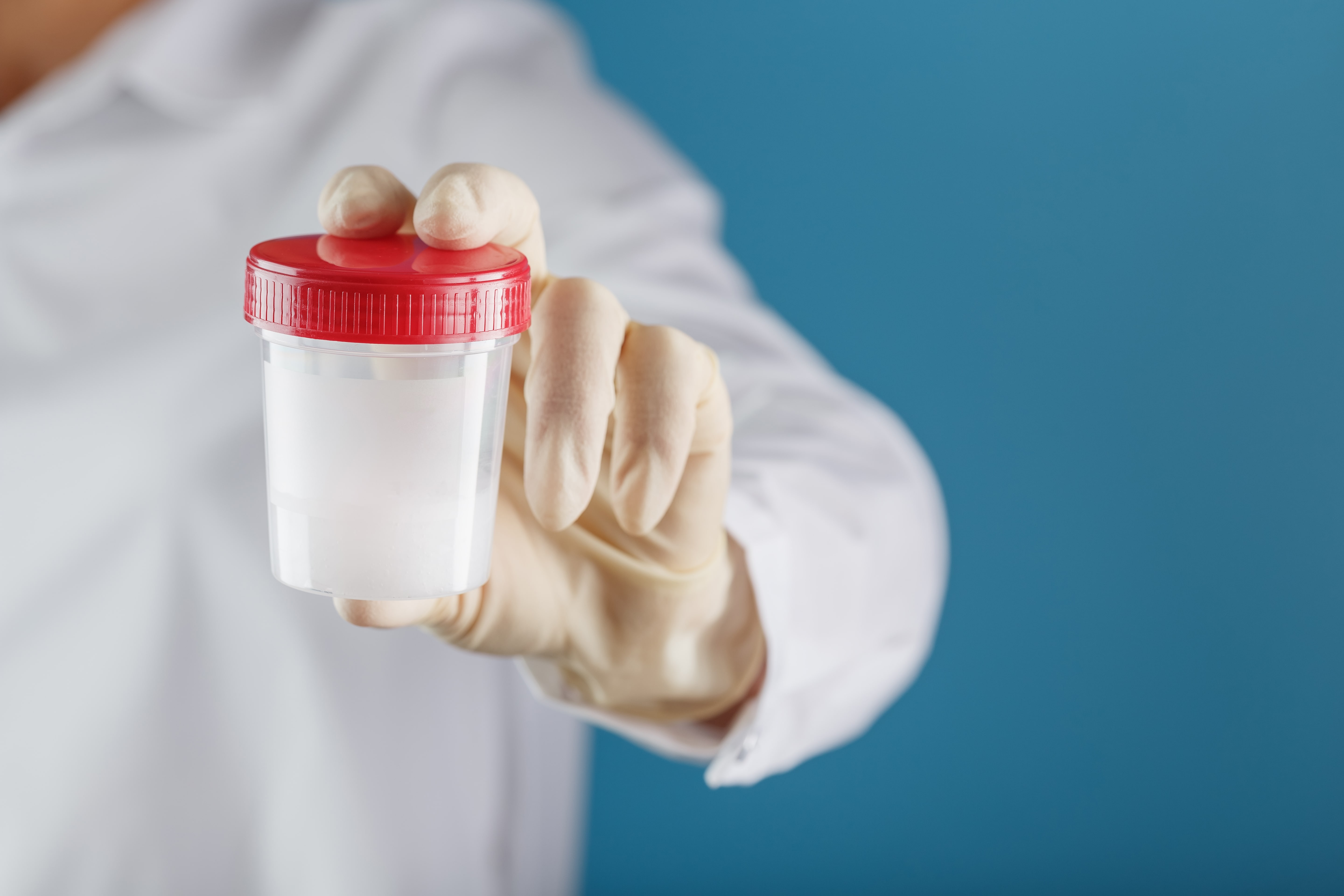 O czym może świadczyć krwiomocz?